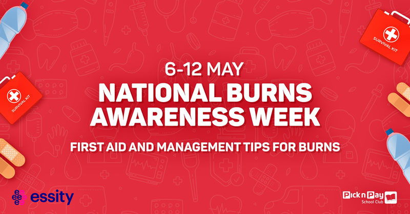 First Aid and Management Tips for Burns